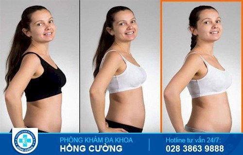 Các chị em có thể nhìn bụng biết có thai thông qua sự thay đổi rõ rệt ở tháng thứ 3