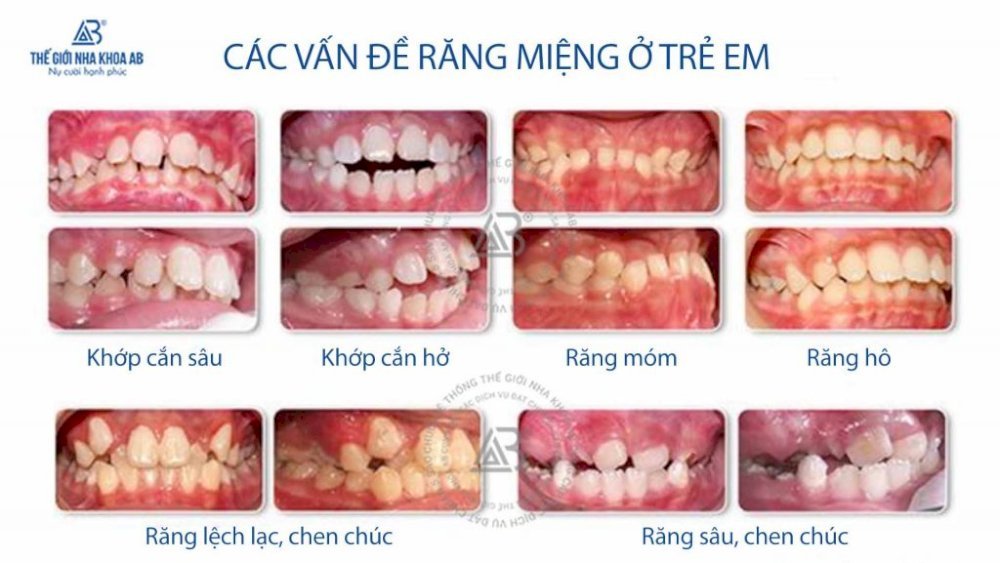 nha-khoa-tre-em4