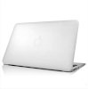 Case MacBook Air 11 inch_small 0