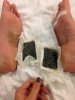 Miếng dán thải độc bàn chân Lanna Foot Patch Thái Lan - HX1708_small 0