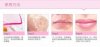 Combo 10 Mặt nạ môi BIOAQUA Collagen Nourish Lips Membrane Mask - HX1010 - Ảnh 10