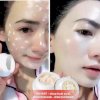 Kem dưỡng trắng da ngọc trai làm mờ vết thâm nám tàn nhang đồi mồi đốm nâu Drmeinaier whitening cream flawless - HX1997 - Ảnh 10