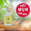 Serum Giảm Mụn Ẩn ,Mụn Đầu Đen ,Mụn Thâm - Ảnh 3