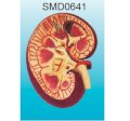 Mô hình hệ thống mạch máu thận SMD0641 Suzhou,TQ 