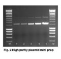 Bioline ISOLATE II Plasmid Mini Kit ( Kít Tinh Sạch Plasmid)