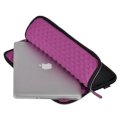 Túi chống sốc cho Macbook Air X-doria 11inch