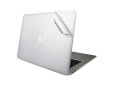 Dan MacBook Air 11 inch iMashi