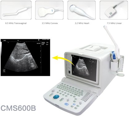 Máy siêu âm xách tay CMS 600B