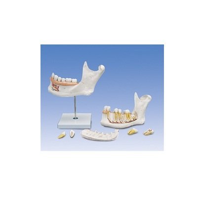 Mô hình răng nữa hàm dưới D25 gồm 6 phần