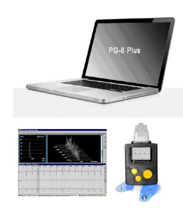 Holter điện tim Progetti PG-8 plus