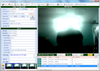 Phần mềm soi cổ tử cung TisaSoft 