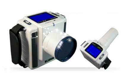 Bộ chụp Xquang nha khoa kỹ thuật số cầm tay DIOX-602