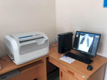 Máy đọc X-quang kỹ thuật số để bàn FCR PRIMA T2
