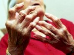 Tsthienquang: Tìm Hiểu Bệnh Thấp Khớp - Bệnh Viêm Khớp Dạng Thấp