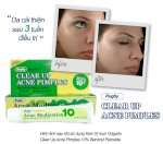 Kem Trị Mụn Trắng Da Vulgaris Clear Up Acne Pimples 10% Benzoyl Peroxide