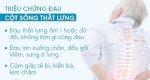 Thoái Hóa Cột Sống, Thoát Vị Đĩa Đệm, Viêm Đa Khớp Dạng Thấp, Đau Vai Gáy, Thần Kinh Tọa, Thần Kinh Liên Sườn Bằng Phương Pháp Thủy Châm