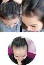 Chai Xịt Kích Thích Mọc Tóc - Biota Oriental Hair Tonic Hàn Quốc
