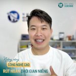 Top 5 Địa Chỉ Làm Hàm Trainer Cho Trẻ Em Tại Hà Nội