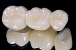 Top 5 Địa Chỉ Trồng Răng Implant Tại Hải Phòng