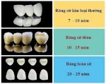 Top 10 Địa Chỉ Trồng Răng Implant Tốt Nhất Tỉnh Lâm Đồng
