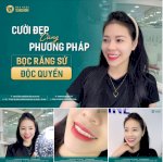 Niềng Răng Mắc Cài Kim Loại Tự Buộc: Giá Và Quy Trình