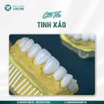 Trồng Răng Giả Có Đau Không? Đau Bao Lâu Khỏi?