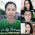 Làm Trắng Da Mặt Ở Đâu Được Hội Chị Em Ưa Chuộng Nhất