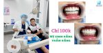 Vệ Sinh Răng, Trám Răng Chỉ Từ 100K Duy Nhất Tại Blue Dental Q.tân Bình!