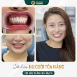 Cẩn Trọng: Bọc Răng Sứ Có Nên Lấy Tủy Không?