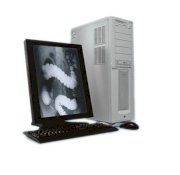 Hệ thống x-quang Smew DSM80