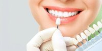 Teeth Cleaning In Milpitas