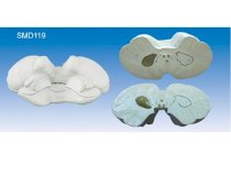 Mô hình tiền não, hành não SMD119 Suzhou 