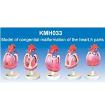 Mô hình dị tật bẩm sinh của tim KeMaJo KMH033
