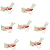 Mô hình nữa hàm răng dưới với 8 loại bệnh về răng VE290 19 phần